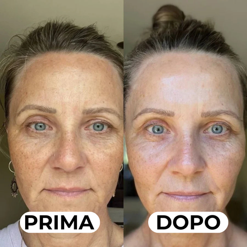 Eyepods | Medline™