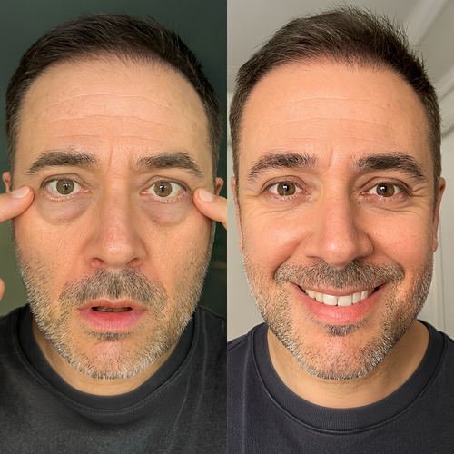 Eyepods | Medline™